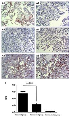 Expression of EGFR in Pituitary Corticotroph Adenomas and Its Relationship With Tumor Behavior